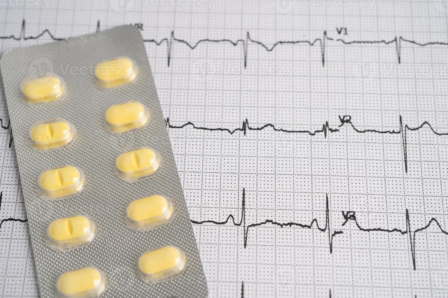 electrocardiograma ecg con píldora droga, corazón ola, corazón ataque, cardiograma informe. foto