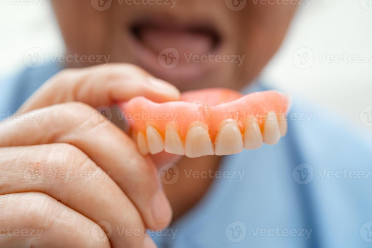 Asian elderly woman patient holding to use denture, healthy strong medical concept. photo