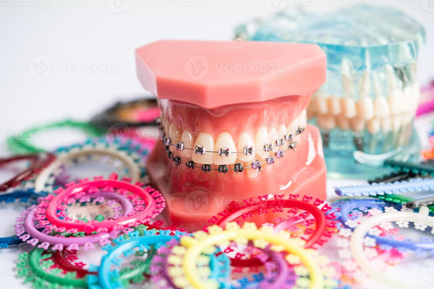 Orthodontic ligatures rings and ties, elastic rubber bands on orthodontic braces, model for dentist studying about dentistry. photo