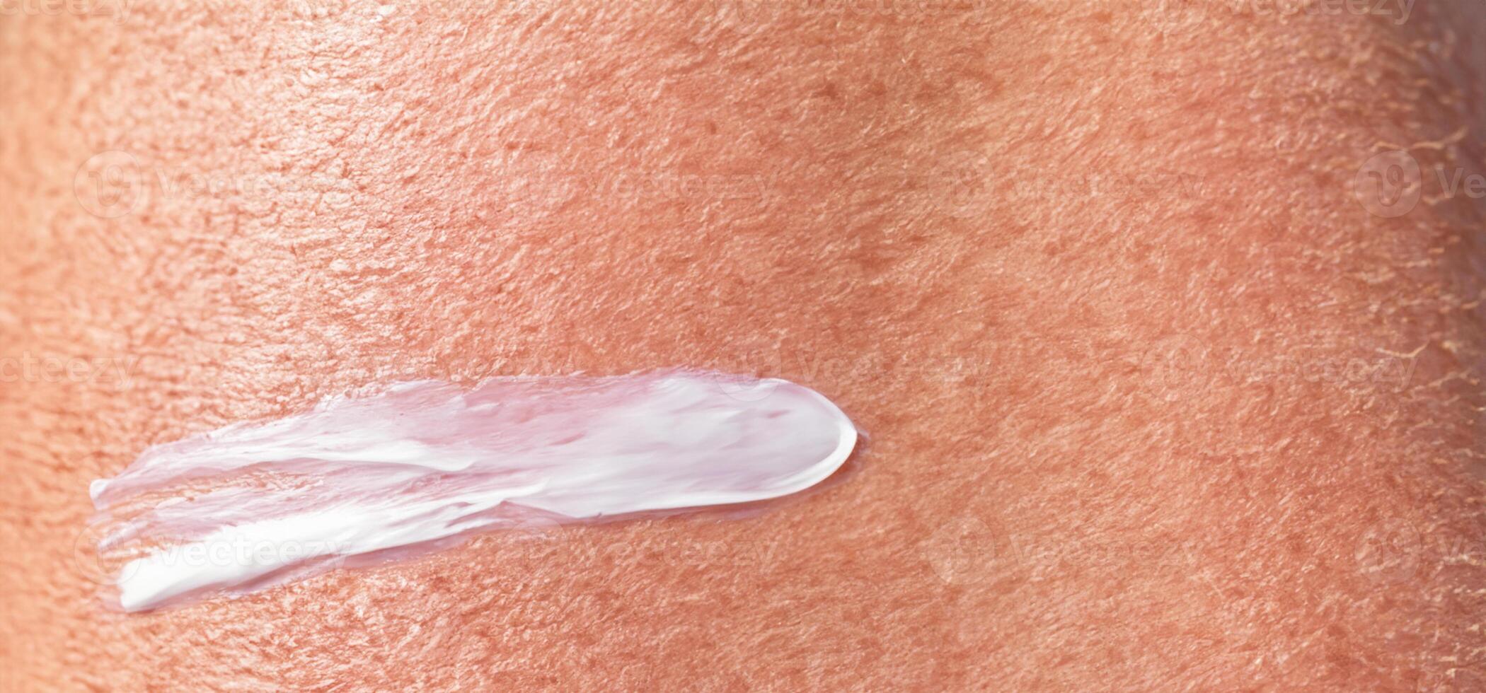 Close up of Sunscreen Protection or Sun Cream on human skin. photo