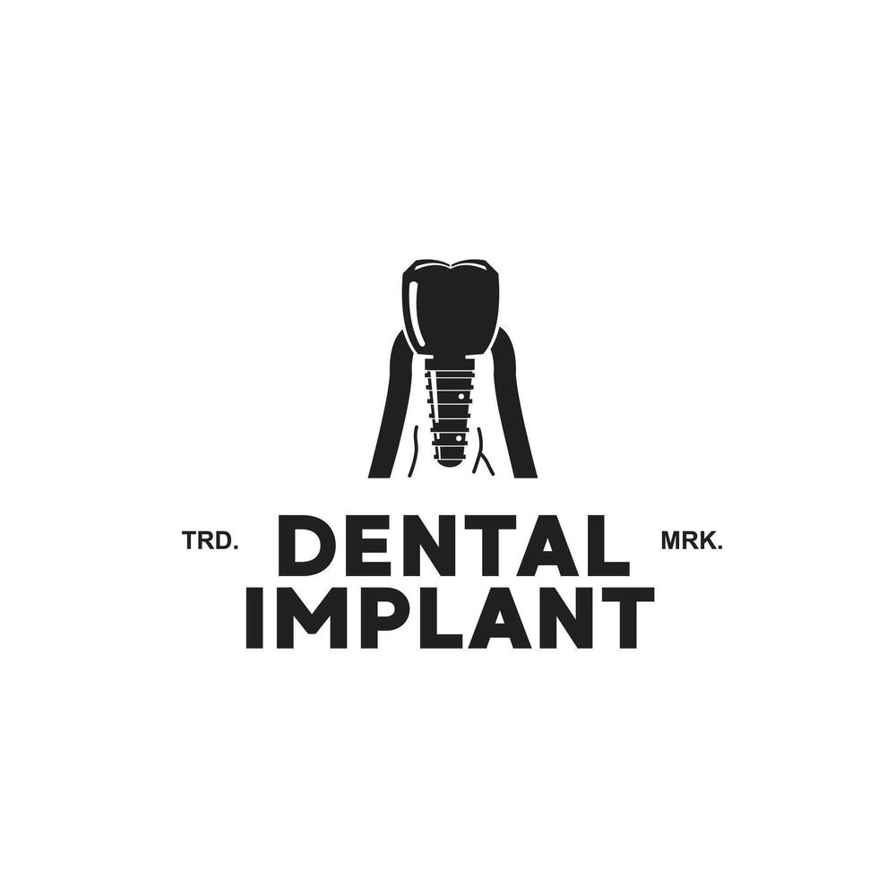 vector ilustración de dental implante logo icono con diente y tornillo