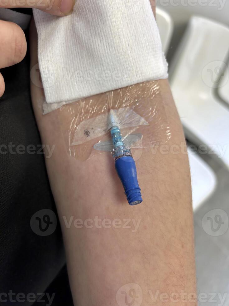 A person's arm is wrapped in a bandage with a blue photo