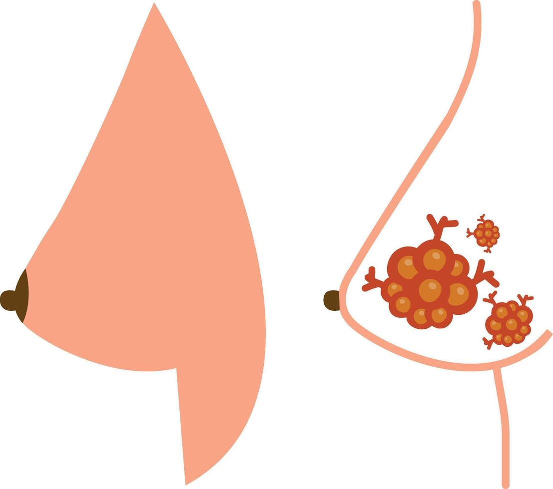 Breast cancer line and glyph icon, oncology and treatment, breast tumor vector icon, vector graphics