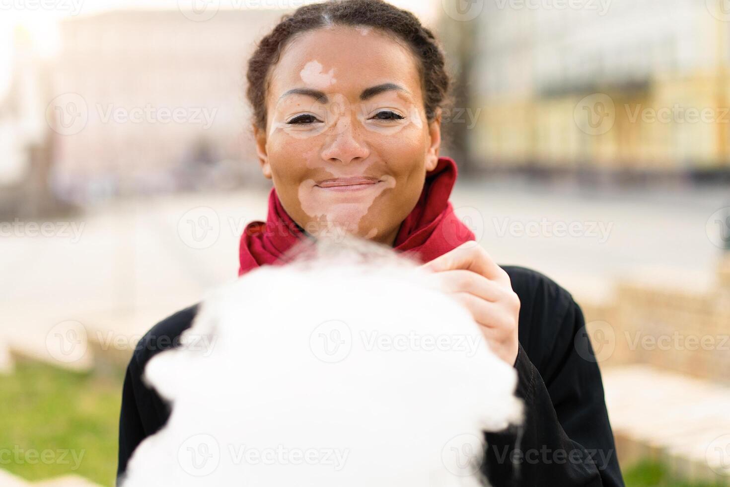 A beautiful young girl of African ethnicity with vitiligo isolated eating cotton candy and smiling photo