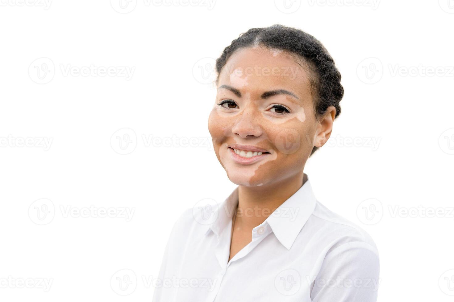 A beautiful young girl of African ethnicity with vitiligo isolated on the white background photo