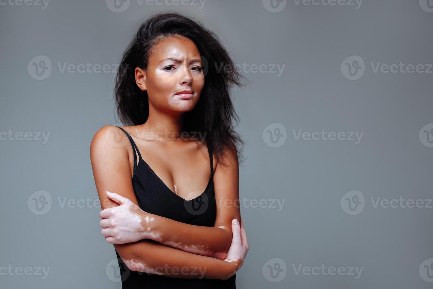 beautiful african girl with a skin problem hugging herself in a studio with both hands photo