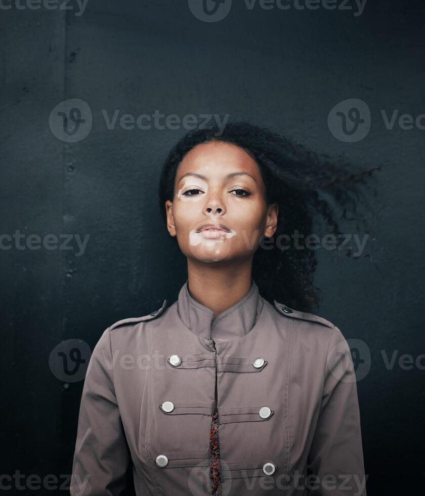 beautiful young brunette woman with vitiligo disease photo