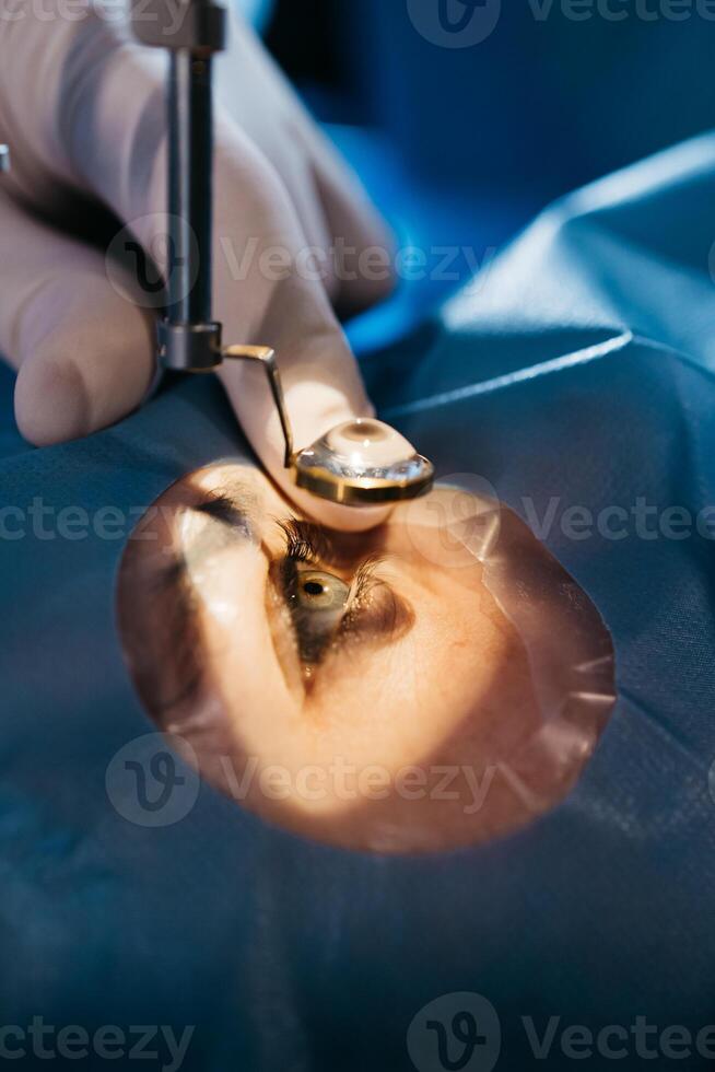 Vision correction with microscope. Surgeon's hands in gloves performing laser eye vision correction. ophthalmology , medicine, people health concept photo