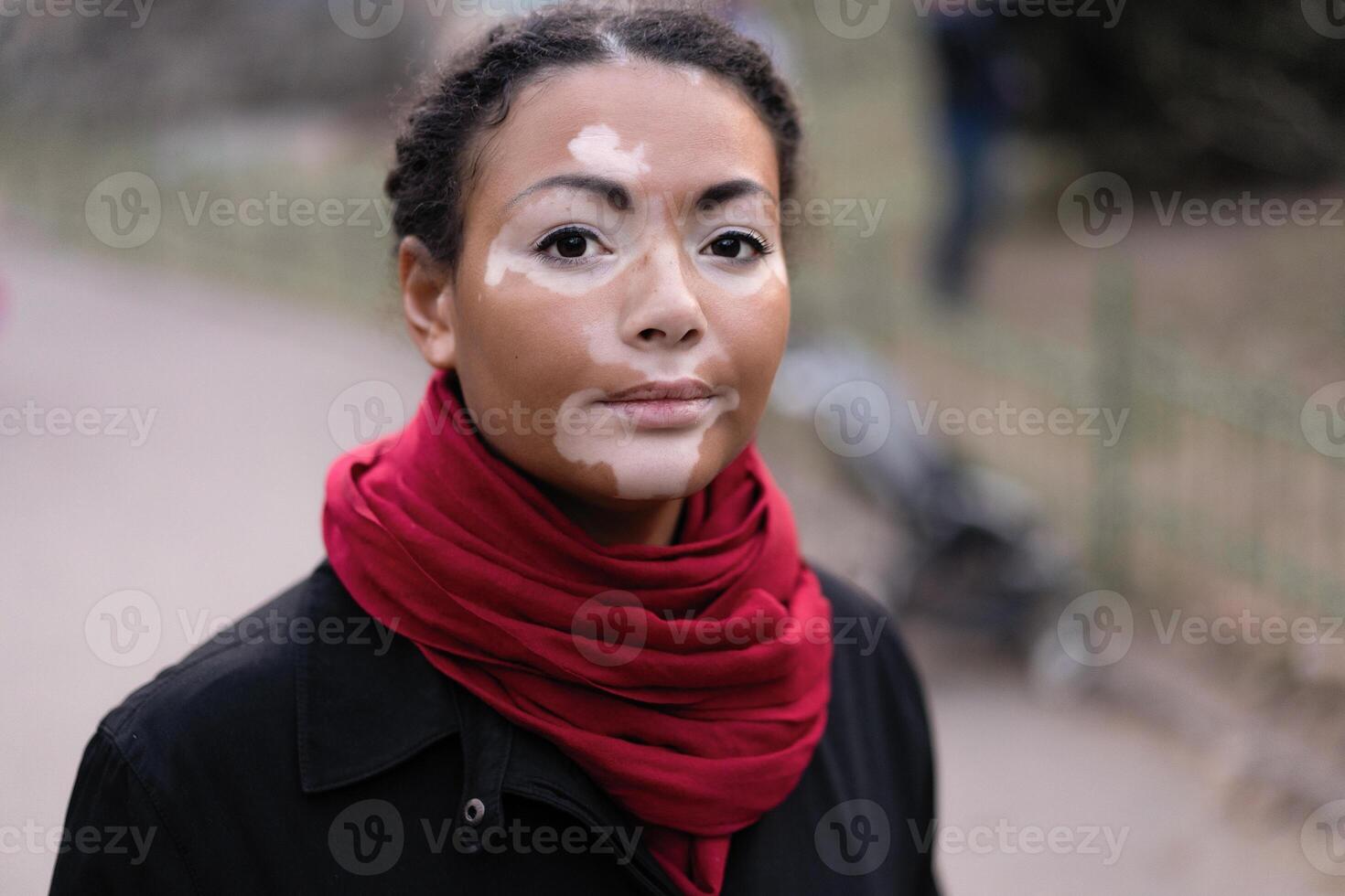 A beautiful young girl of African ethnicity with vitiligo standing on the warm spring city street dressed black coat photo