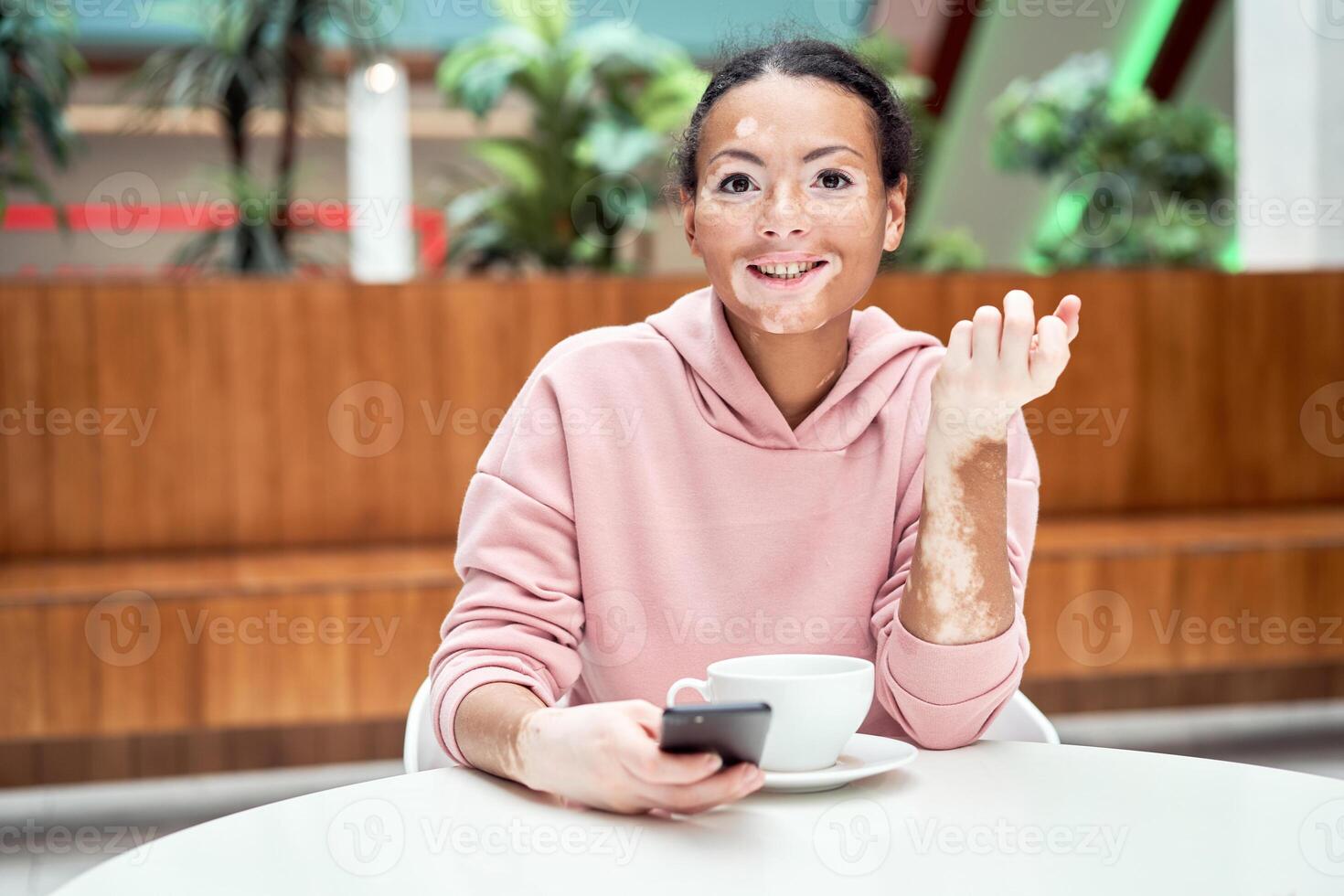 Black african american woman with vitiligo pigmentation skin problem indoor dressed pink hoodie photo