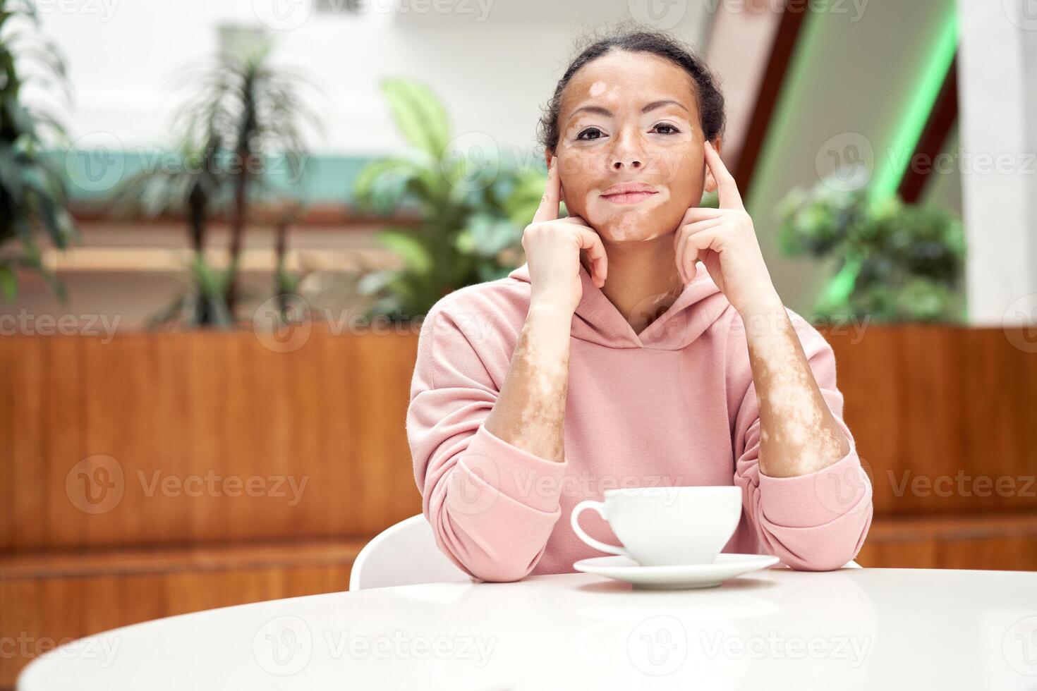 Black african american woman with vitiligo pigmentation skin problem indoor dressed pink hoodie photo