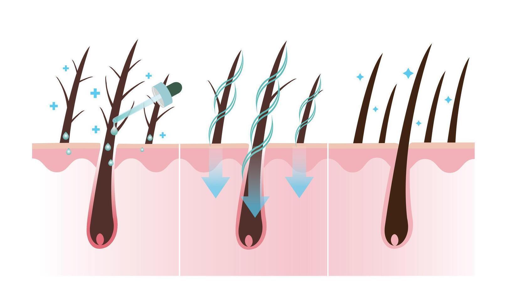 paso de tratar dañado pelo vector aislado en blanco antecedentes. el mecanismo de división termina pelo tratamiento y sano pelo cuero cabelludo capa. pelo anatomía, pelo estructura. pelo cuidado concepto ilustración.