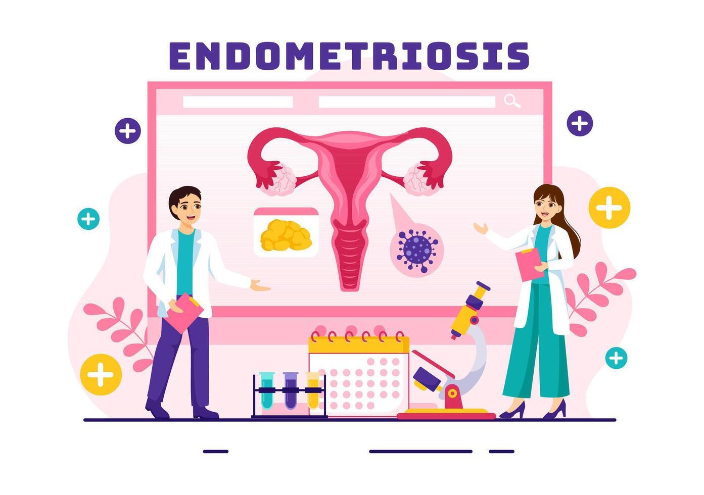 Endometriosis Vector Illustration with Condition the Endometrium Grows Outside the Uterine Wall in Women for Treatment in Flat Cartoon Background
