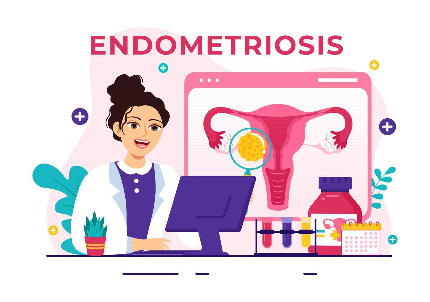 endometriosis vector ilustración con condición el endometrio crece fuera de el uterino pared en mujer para tratamiento en plano dibujos animados antecedentes