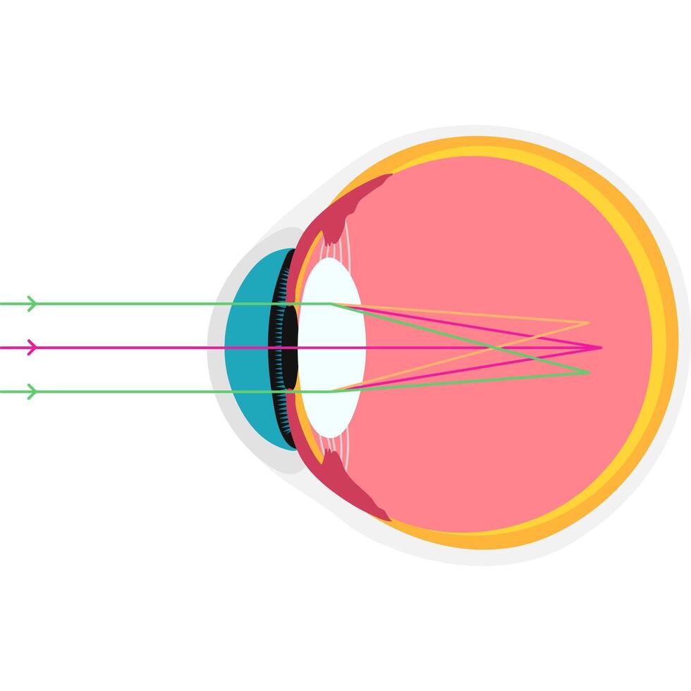 Astigmatic academic diagram structure anatomy vector