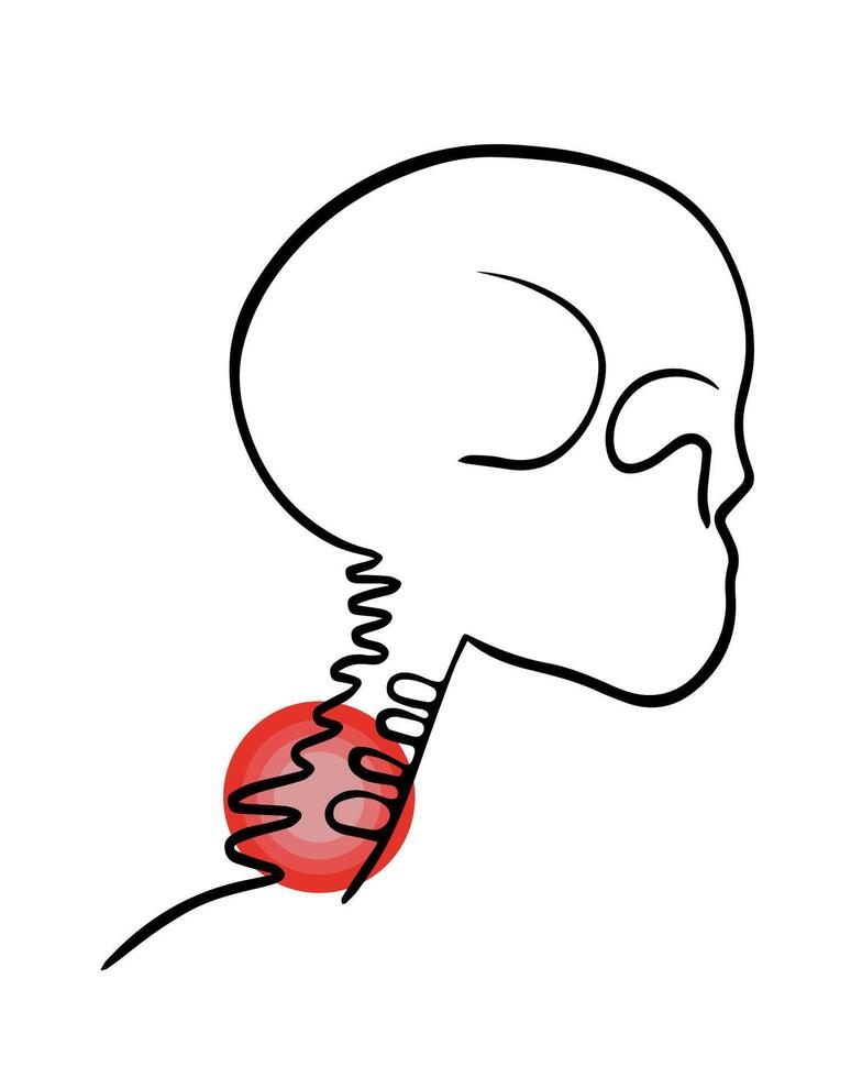 vector aislado ilustración de cervical vértebras dolor. contorno dibujo de el cervical región con localización de dolor en el vértebras.