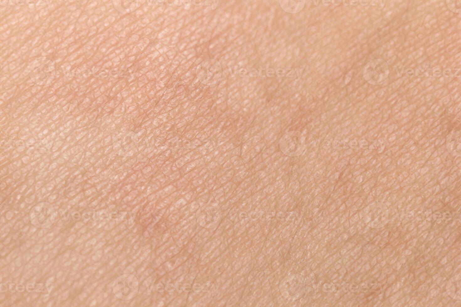 Close Up of Healthy Human Skin Texture with Natural Black Hairs, Ideal Background Concept photo