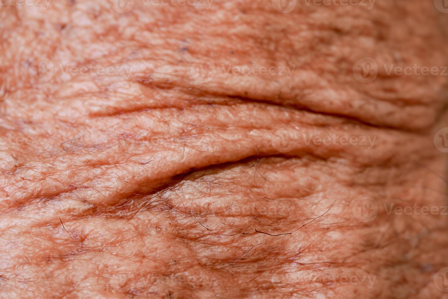 aged man's skin with an abstract background texture. photo