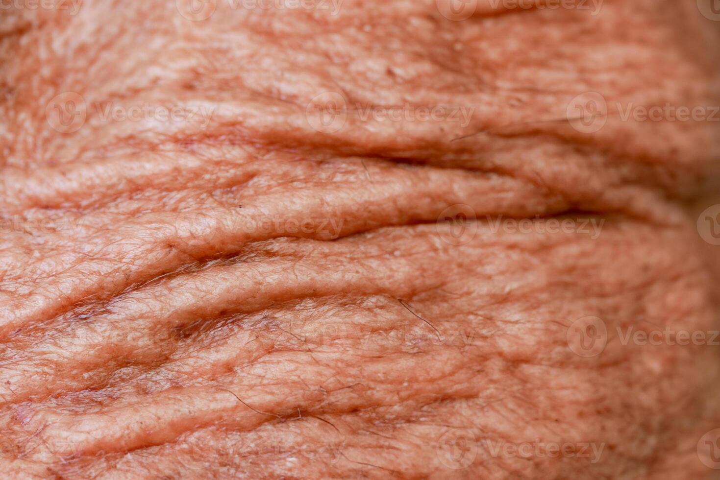 aged man's skin with an abstract background texture. photo