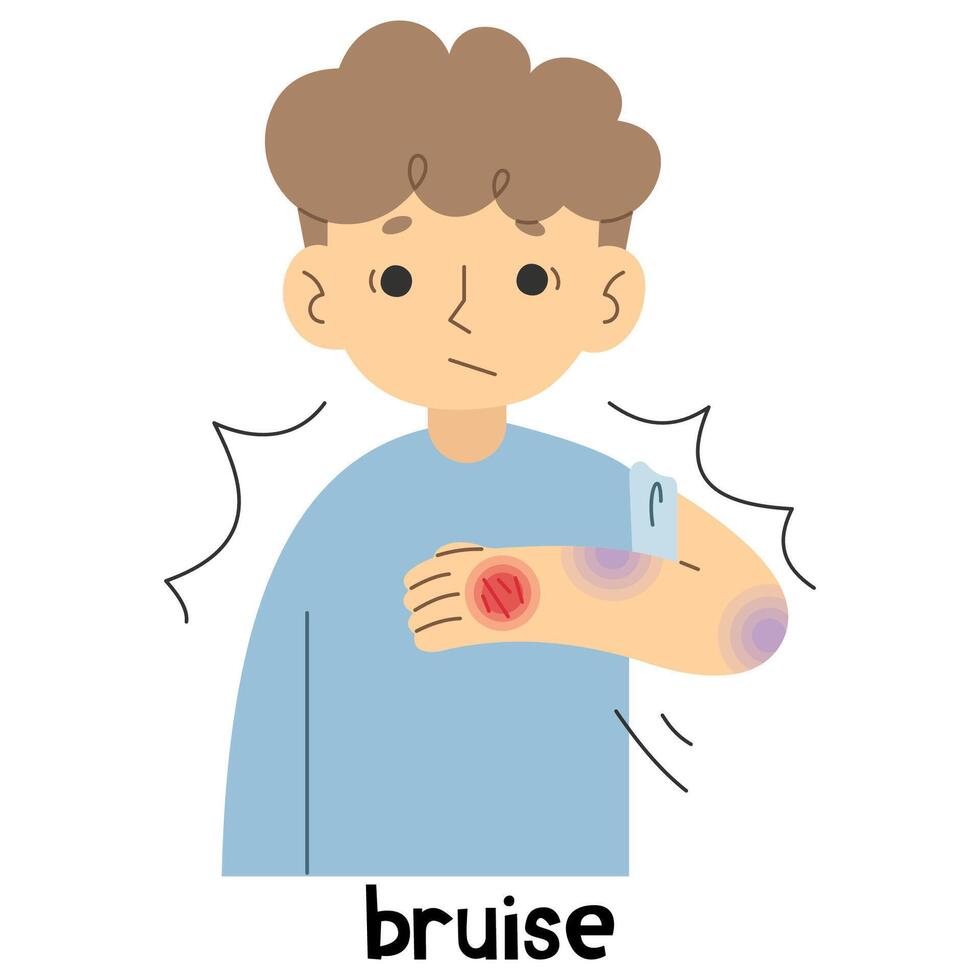 Bruise cute on a white background, vector illustration.