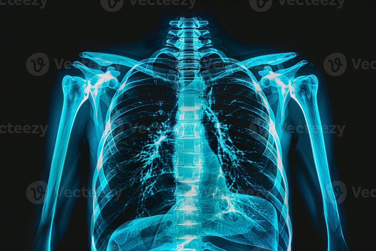 AI generated An X-ray image of the human chest showing the bony structures and the silhouette of the lungs and heart. photo