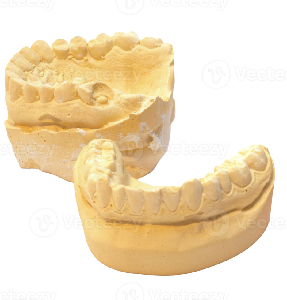 processing and dental impression png