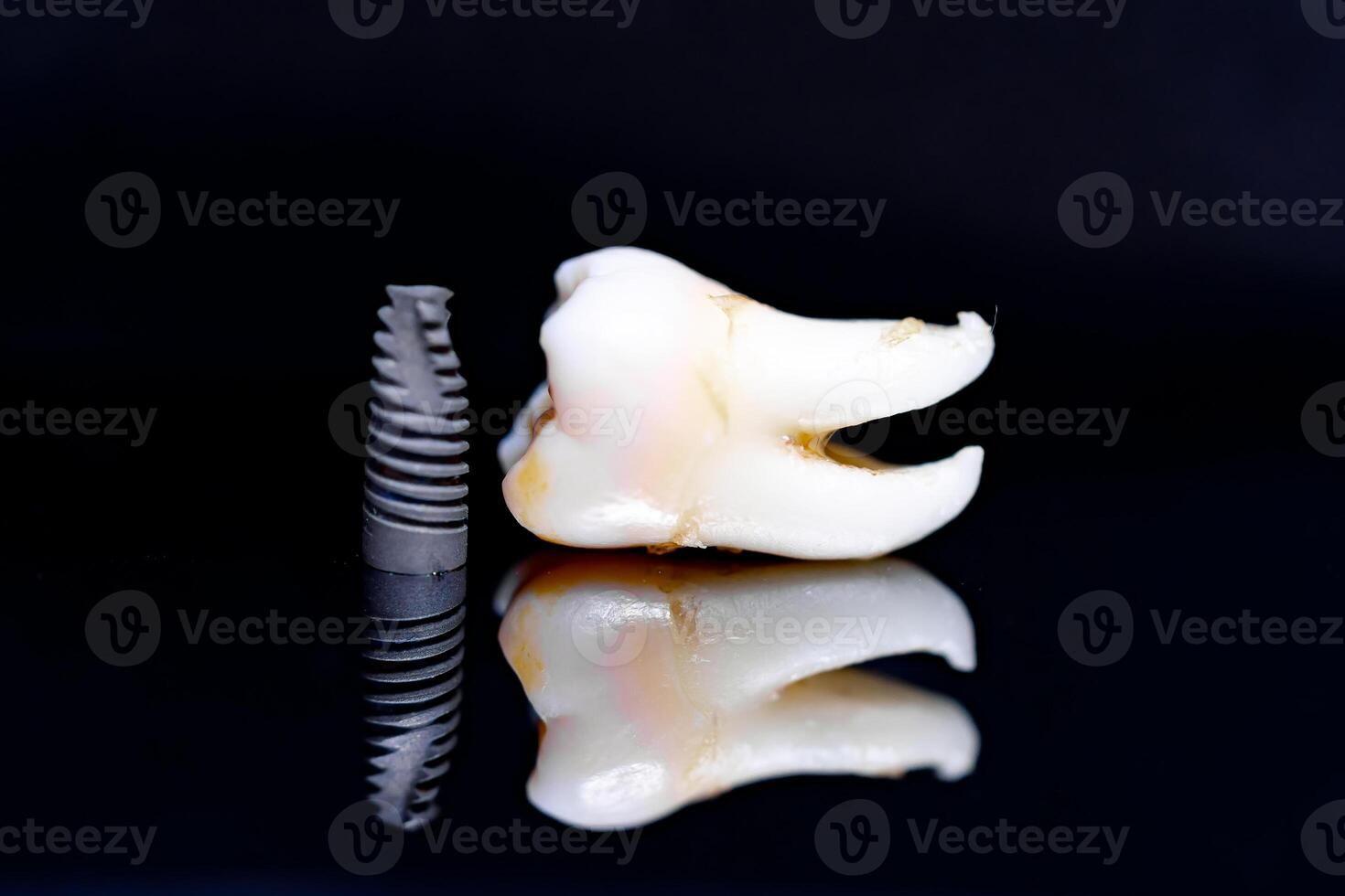 Tooth model and implant on black background. Art photo for dental concept.