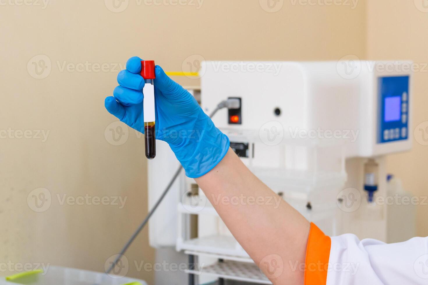 Blood samples for research in microtubes. Hand in latex glove holds blood sample. Selective focus. photo