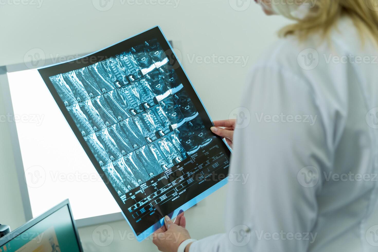 Doctor's hands with computer tomography film or x-ray. Medical room background. photo