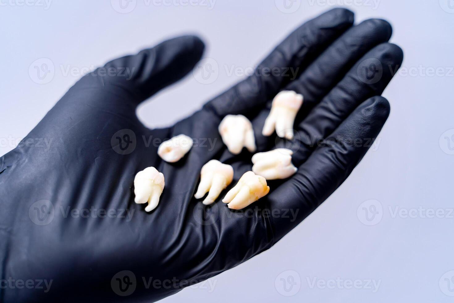 Ceramic dental implants. photo
