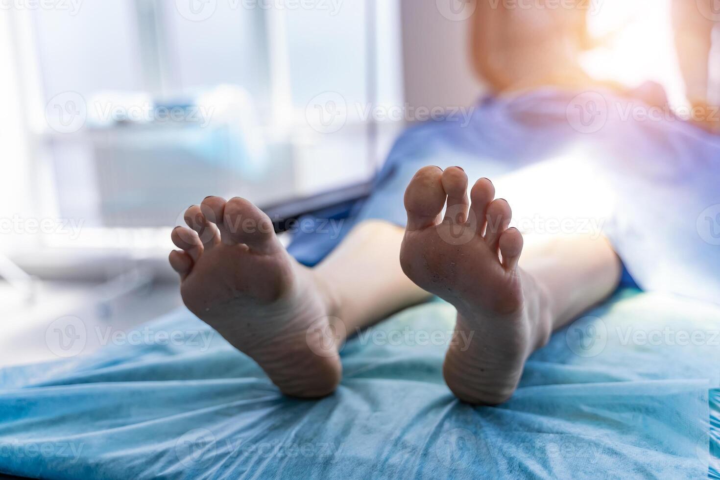 Feet of patient prepared for operation in modern clinic. Selective focus. photo