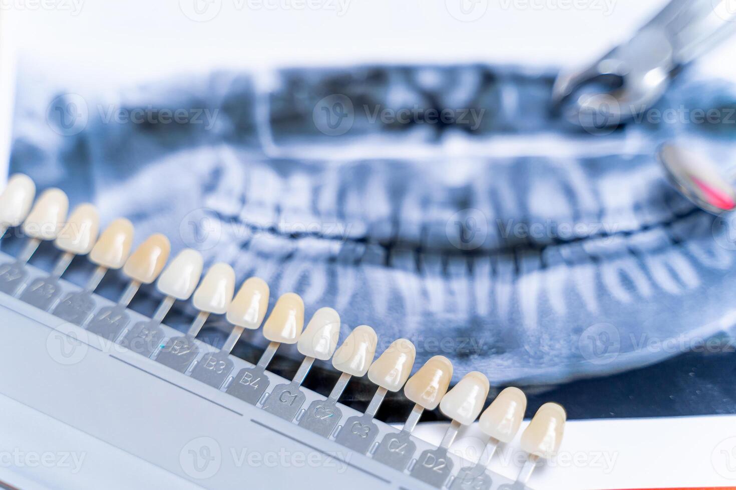 Panoramic jaw x-ray with color tone palette. Dental treatment concept. Closeup. photo