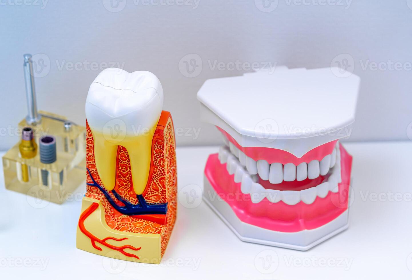 Artificial educational dental model and tooth model for dentists. Stomatology concept. White background. photo