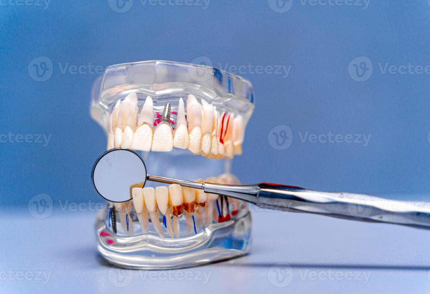 Educational model of tooth and professional tool. Blue background. Closeup photo