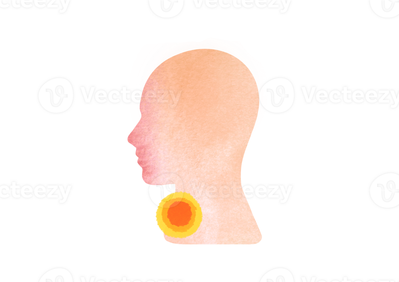 person suffers from Sore throat, runny nose. watercolor silhouette of head in profile with red nose isolated on transparent background. clipart and cut out element png