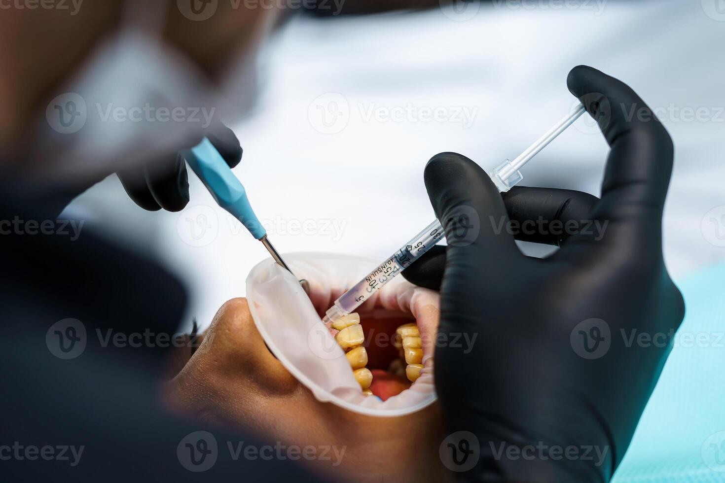 Dentist with client in a dental office. Oral care, healthy teeth, stomatology concept. photo