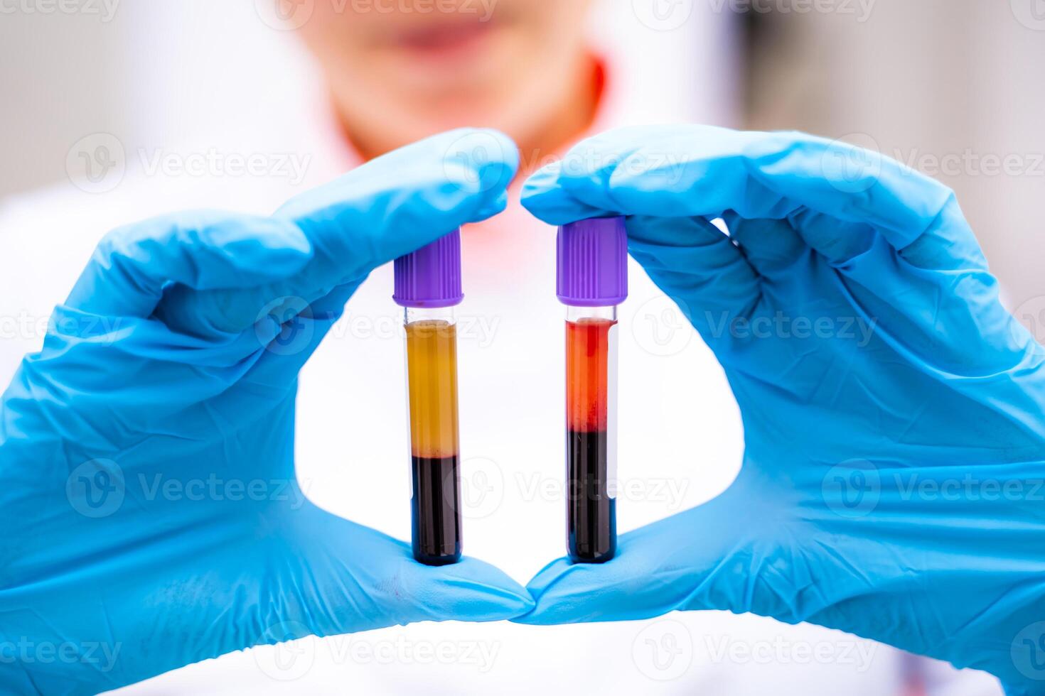 Laboratory assistant with blood samples in hands. Assistance in gloves. Prevention. Pneumonia diagnosing. COVID-19 and coronavirus identification. Pandemic. photo