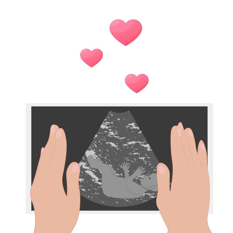 ultrasonido examen procedimiento. el embarazo. un embrión en un ultrasonido escanear. el expectante madre sostiene un foto de el niño en su manos. foto un embrión vector
