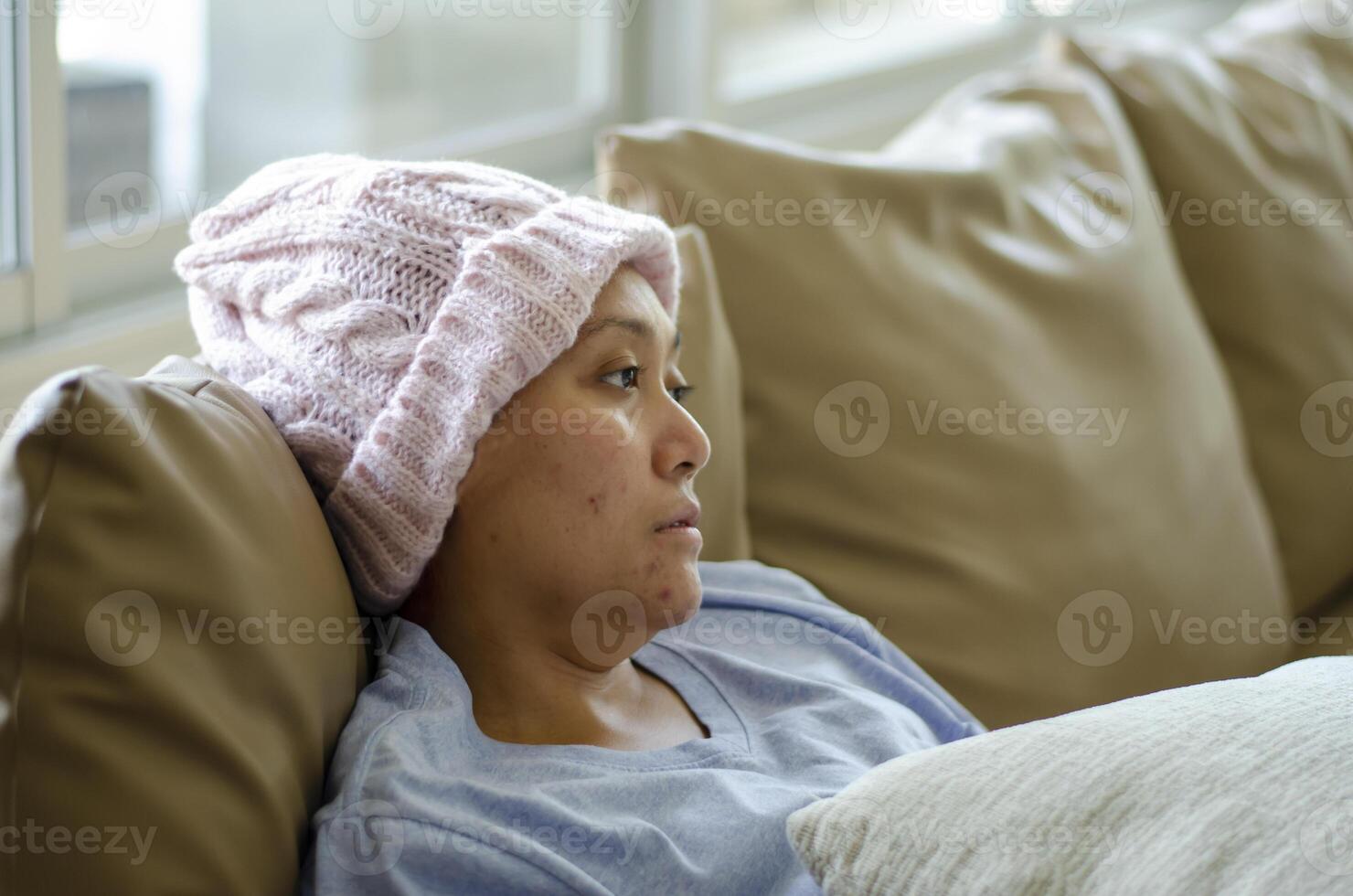 Asian woman with cancer, feeling bad photo