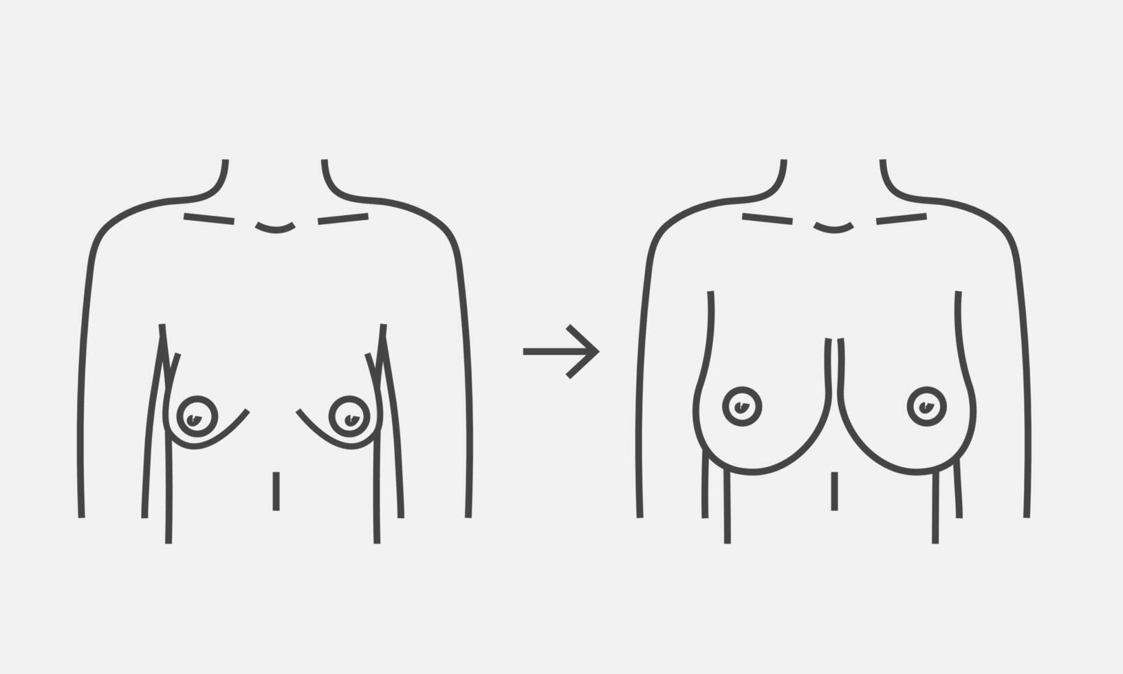 Tuberous breast correction line icon. Plastic surgery, medical procedure. Change shape breast. Vector illustrtion