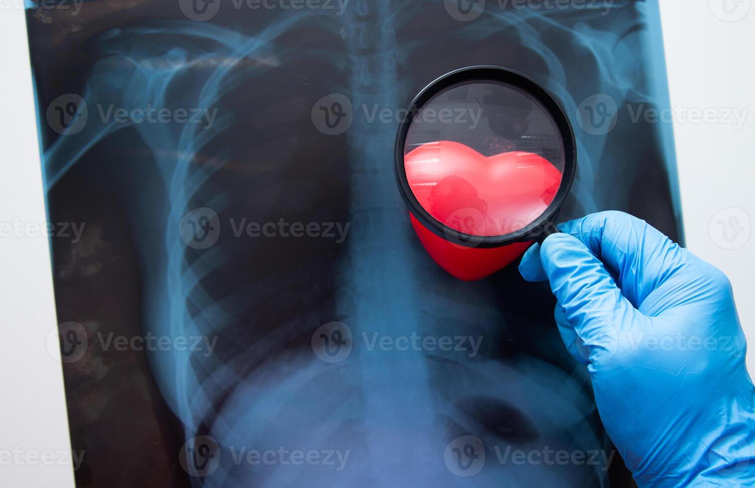 Hand holding Magnifying glass on X ray of a human chest. photo