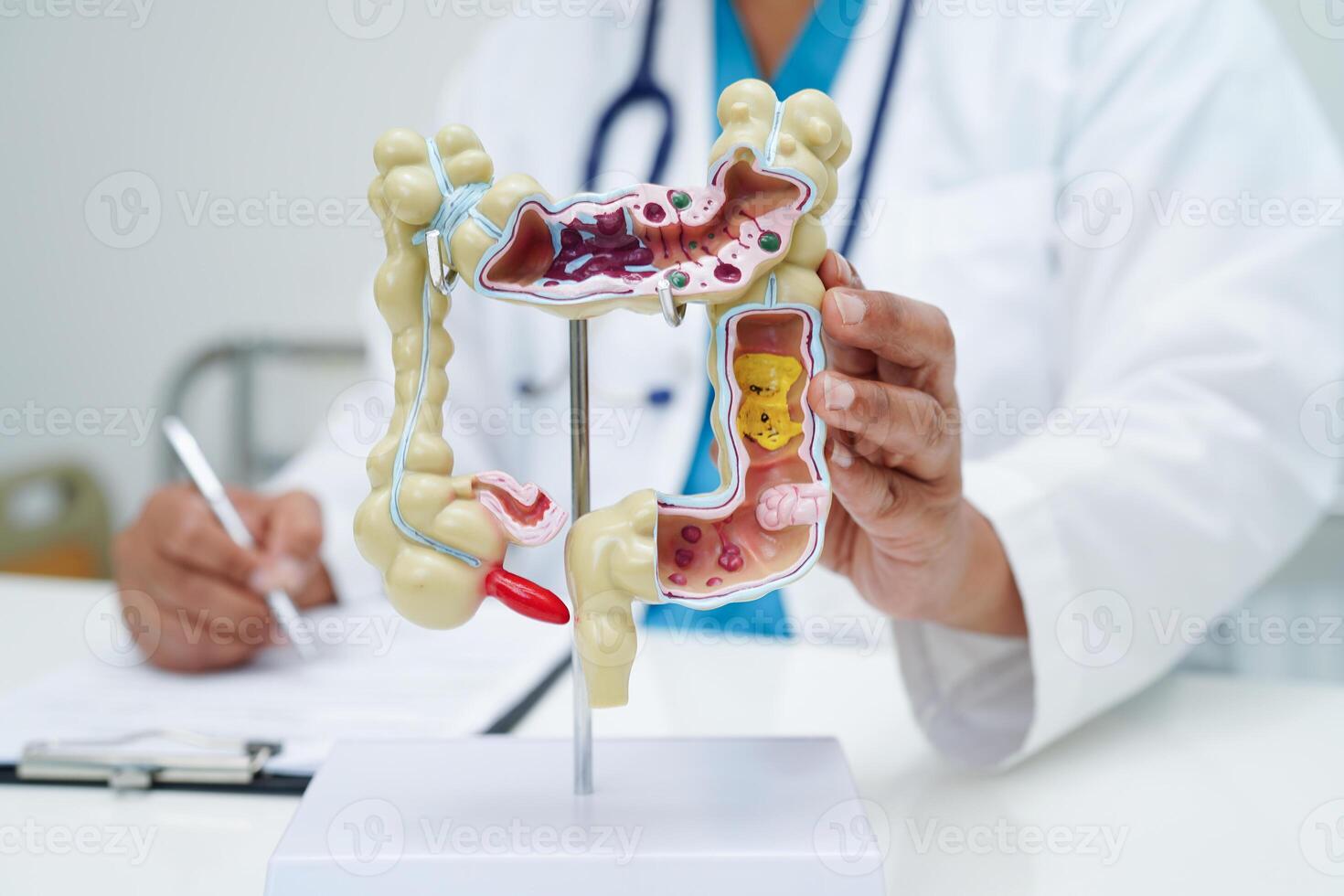 intestino, médico participación humano anatomía modelo para estudiar diagnóstico y tratamiento en hospital. foto