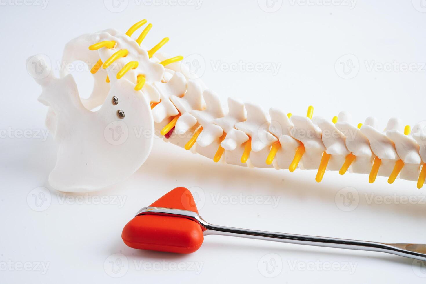 Spinal nerve and bone with knee reflex hammer, Lumbar spine displaced herniated disc fragment, Model for treatment medical in the orthopedic department. photo