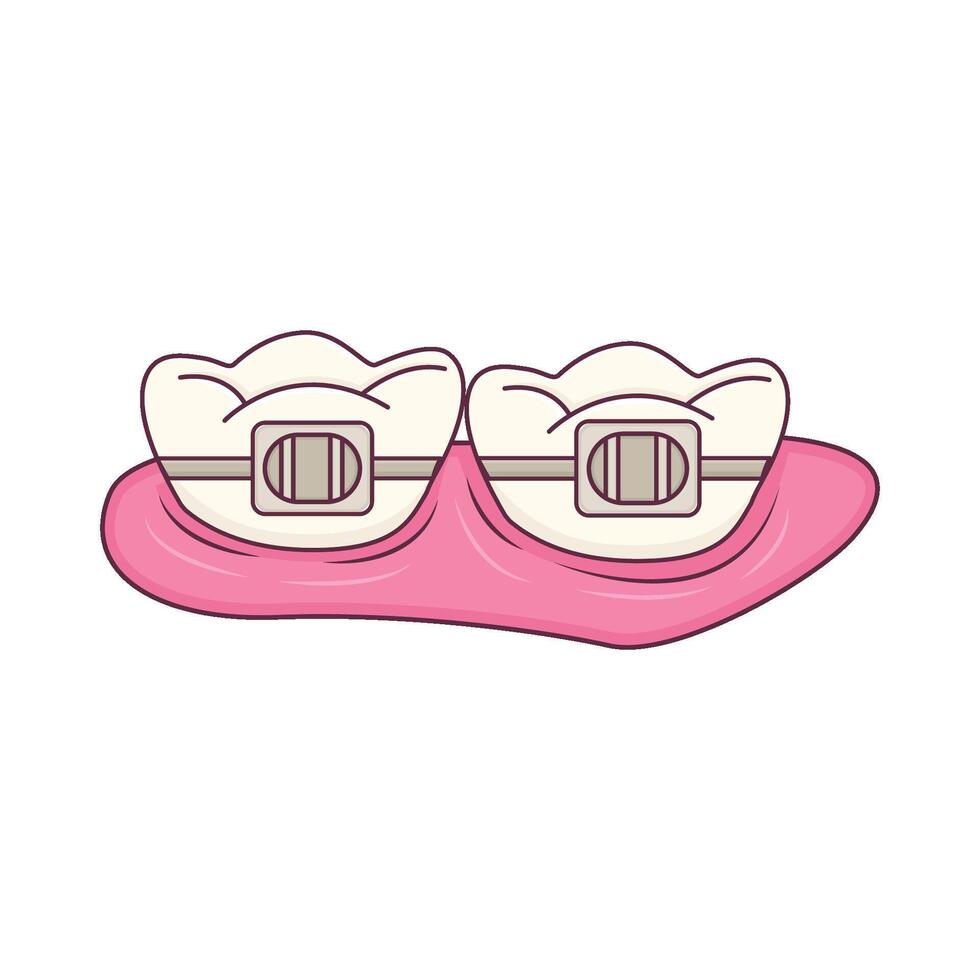 Illustration of braces vector