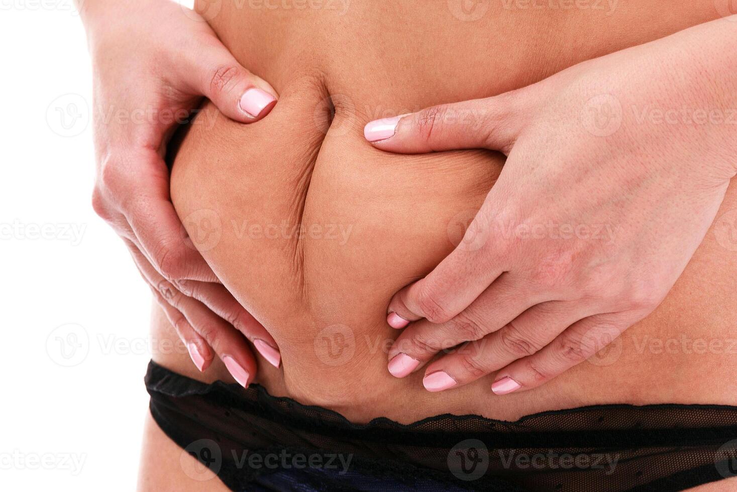 Woman pinches fat on her belly photo