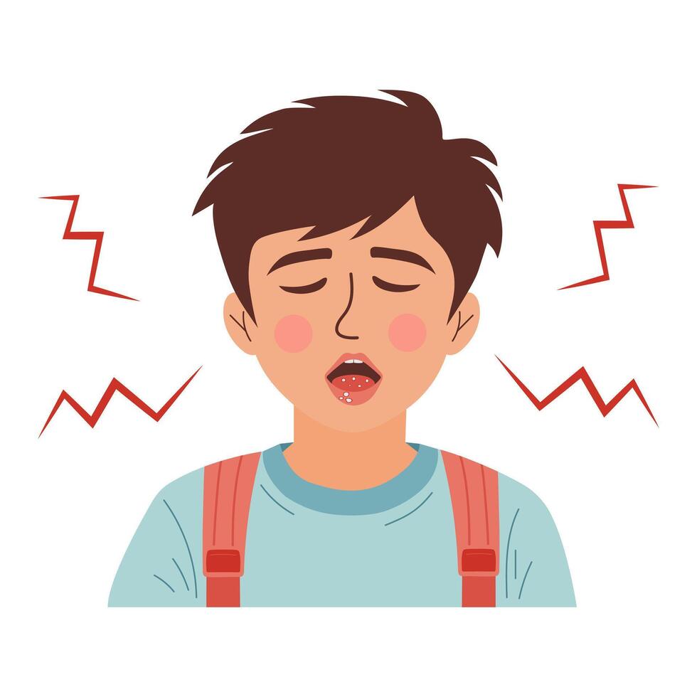 Child with stomatitis in mouth. Diseases of oral cavity. Candidiasis in boy. Mouth ulcer, inflammation of the oral mucosa. vector