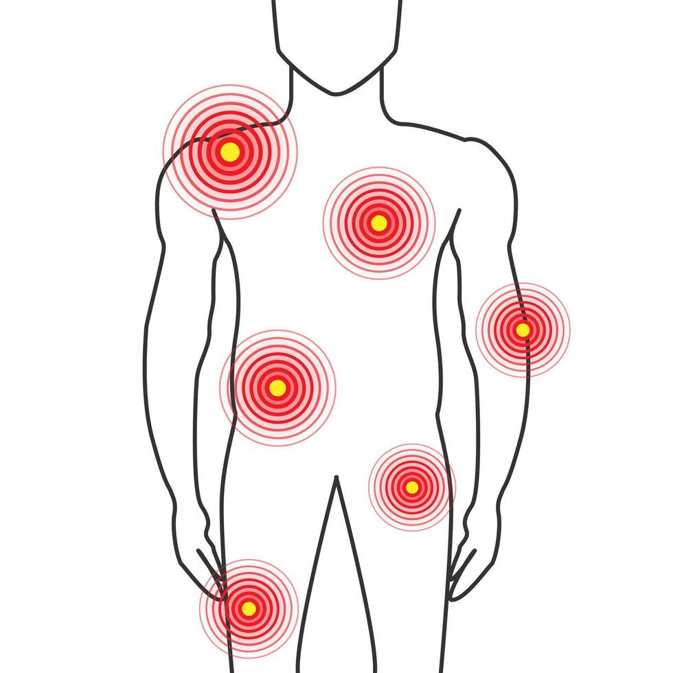 cuerpo partes dolor ilustración con espalda, pecho, articulación, caderas y músculo dolor en hombre vector