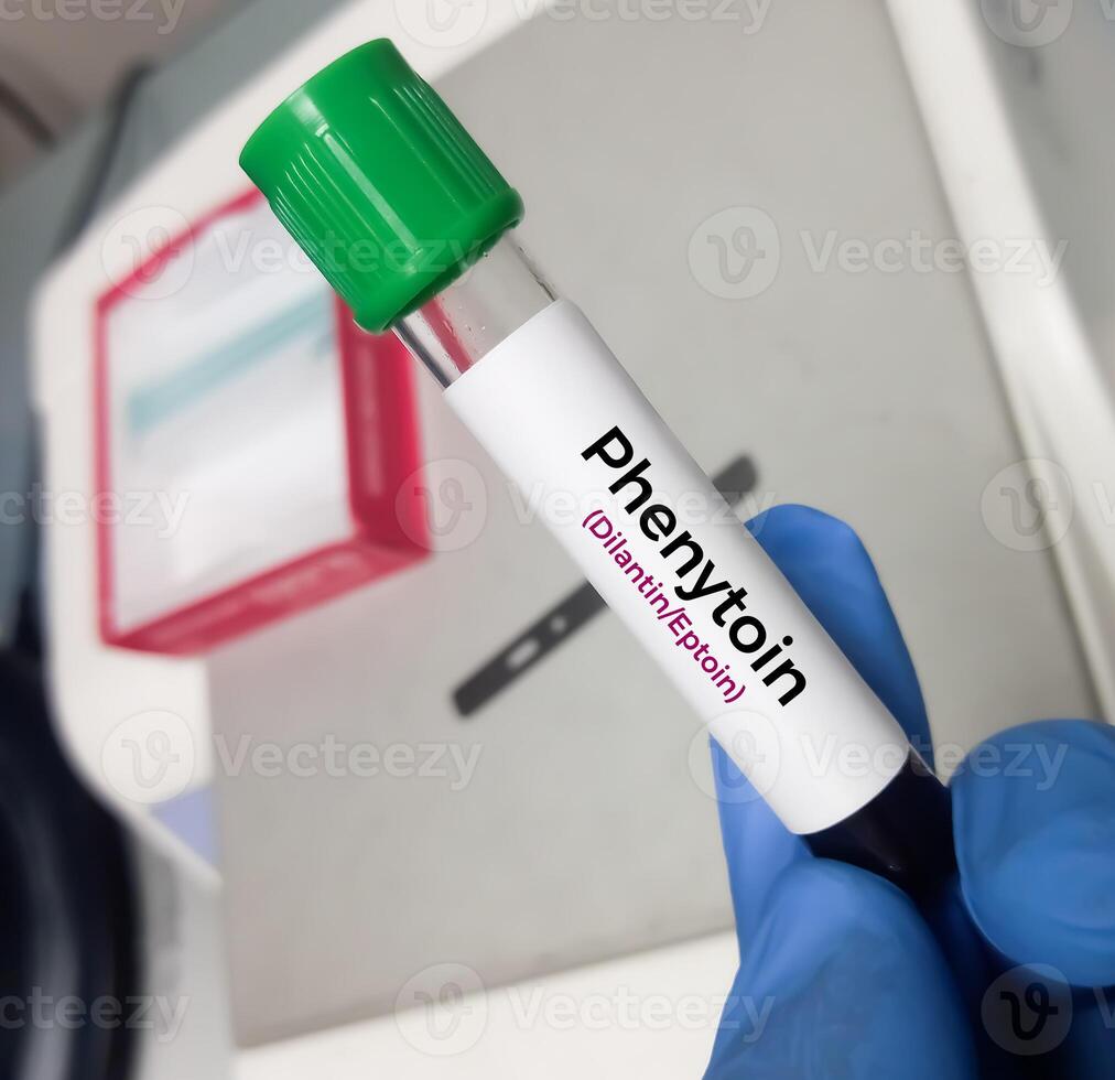 Blood sample for Phenytoin test, therapeutic drug, to maintain a therapeutic level and diagnose potential for toxicity photo