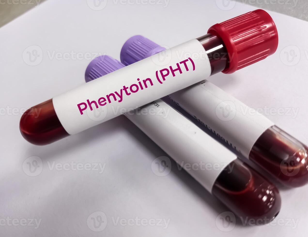 Blood sample for Phenytoin test, therapeutic drug, to maintain a therapeutic level and diagnose potential for toxicity photo