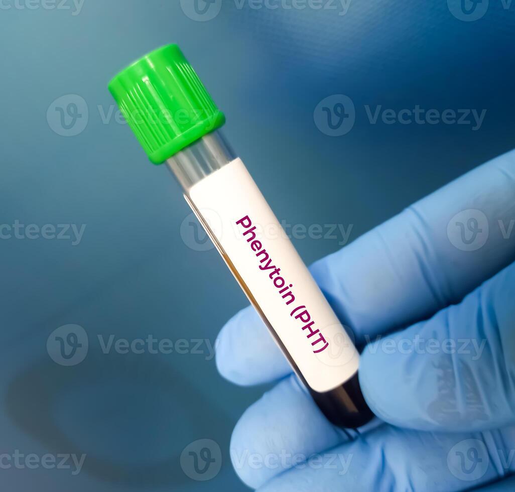 Blood sample for Phenytoin test, therapeutic drug, to maintain a therapeutic level and diagnose potential for toxicity photo